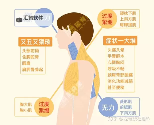 关于嘴巴含胸的感觉知乎:原因分析与应对方法图2