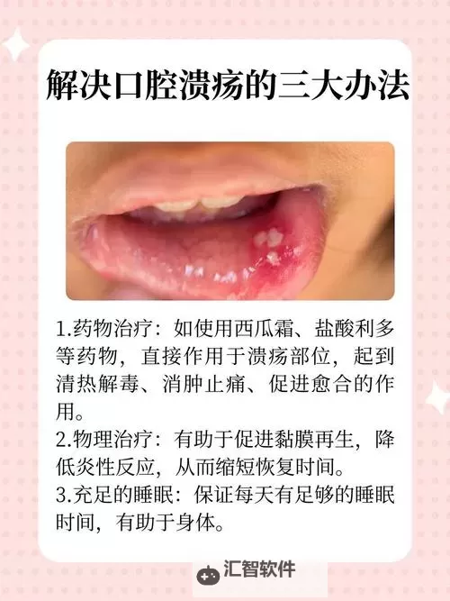 打坐治好口腔溃疡的贴吧：真实经验分享与疗法探讨图1