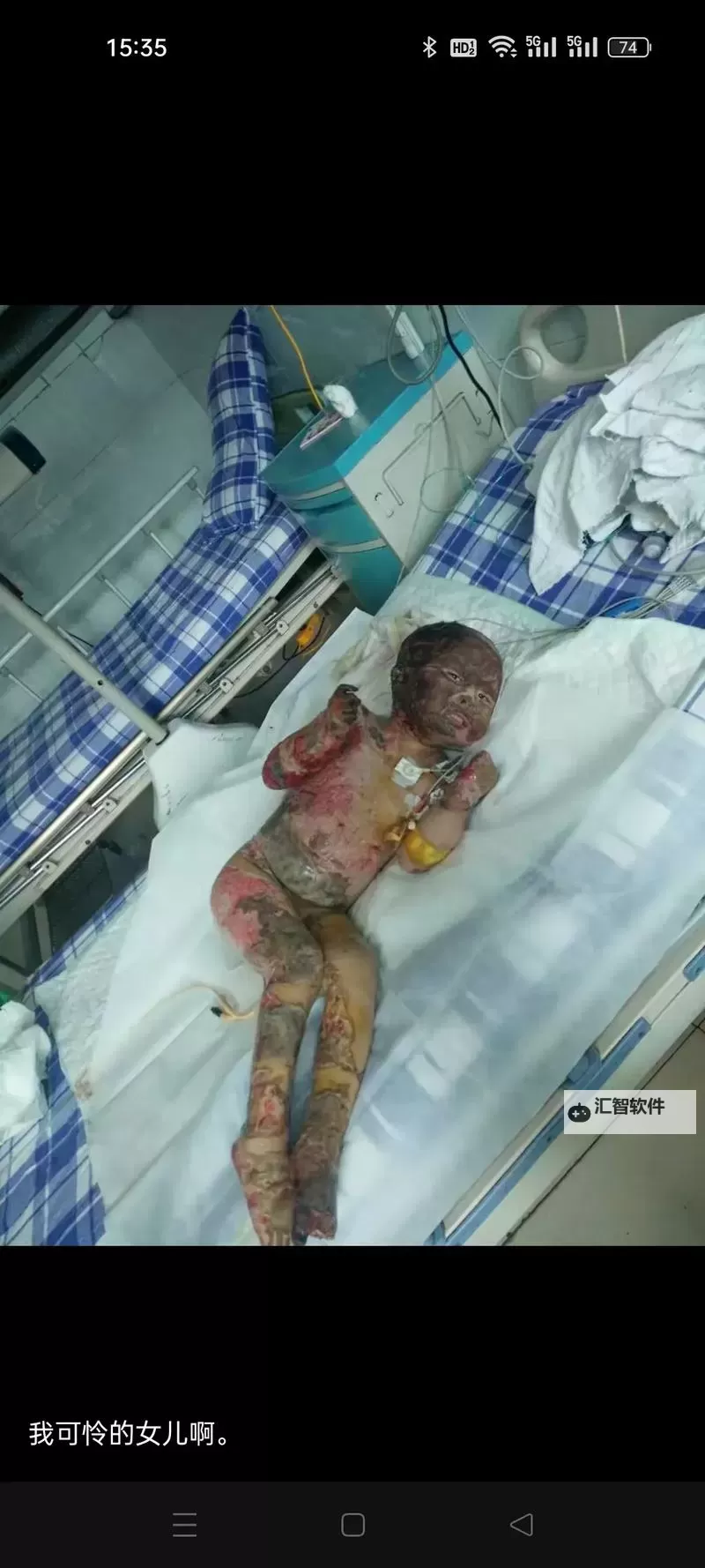 浴室少女的二十天：秘密与成长的瞬间图1