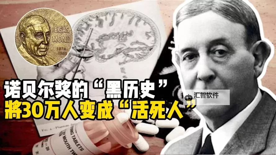 黑历史在线免费观看网址推荐：无需付费尽享高清资源图1