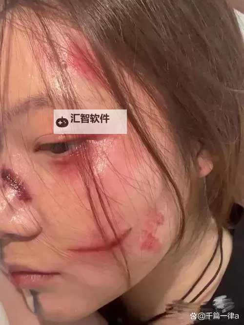 真实破外女摘花流血了：惊心动魄的瞬间揭示人性深处图1