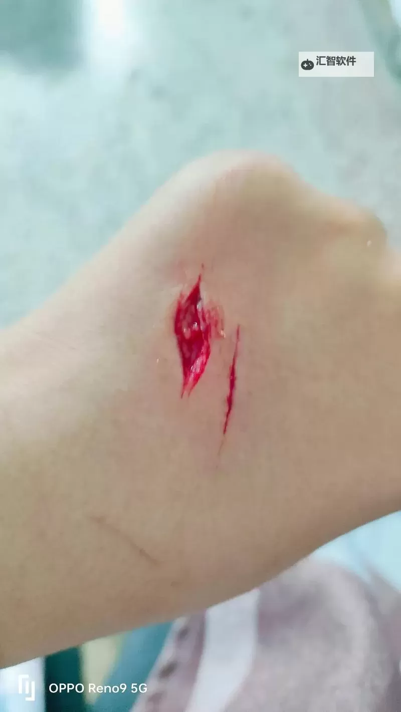 国内免费破外真实出血事件引发关注图1