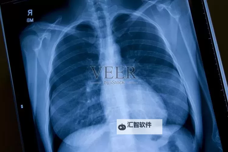 2025年最新政策：如何实现免费看胸片2025的便利与普及图1