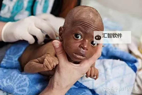 中国未来会黑人化吗？探讨全球化背景下的文化与身份变迁图1